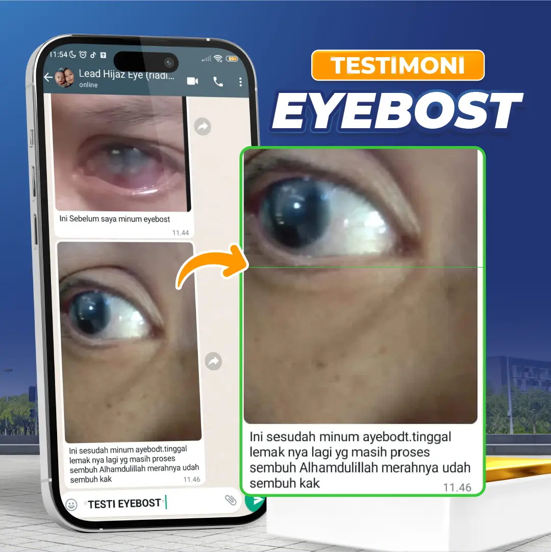 TESTIMONI EYEPRO 7